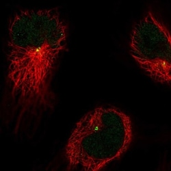 CDIP Antibody, Novus Biologicals:Antibodies:Primary Antibodies